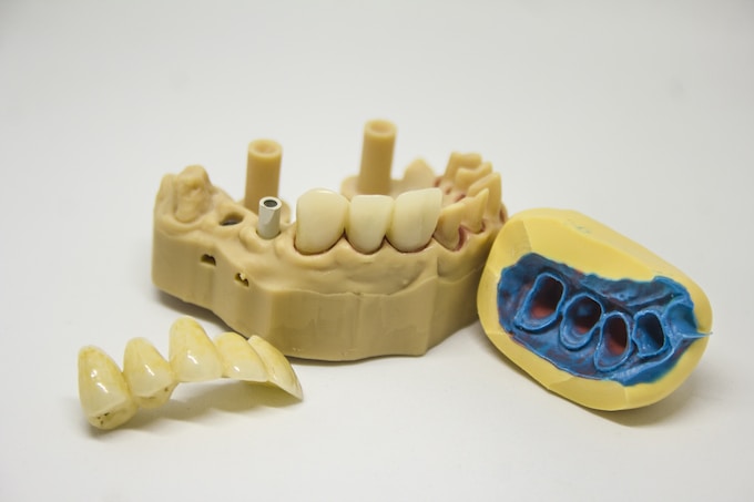 He soñado con dientes agujereados, ¿Cómo interpreto este sueño tan desagradable?